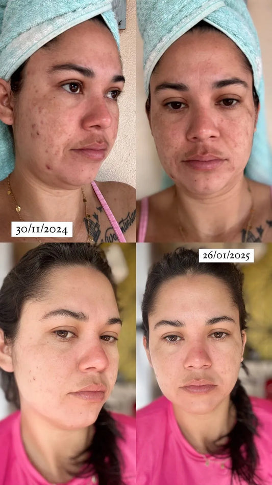 Kit Completo Sérum de Vitamina C20 + Protetor Solar + Gel de Limpeza
